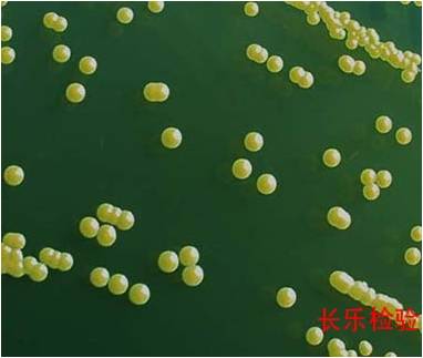 醫(yī)藥行業(yè)：人體存有金黃色葡萄球菌為正?，F(xiàn)象